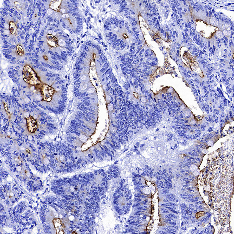 MUC17 Recombinant Rabbit mAb (SDT-3951-108)