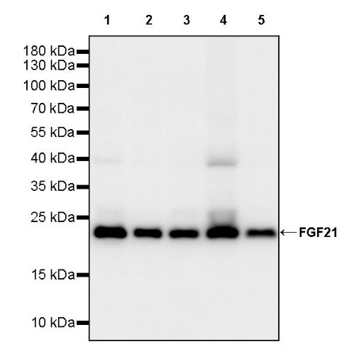 FGF21 Recombinant Rabbit mAb (S-2567-21)