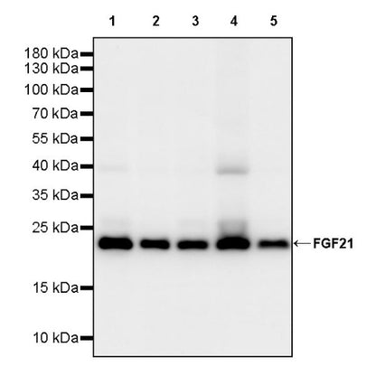 FGF21 Recombinant Rabbit mAb (S-2567-21)