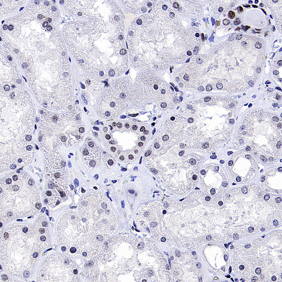TOP2B Recombinant Rabbit mAb (S-4452-44)