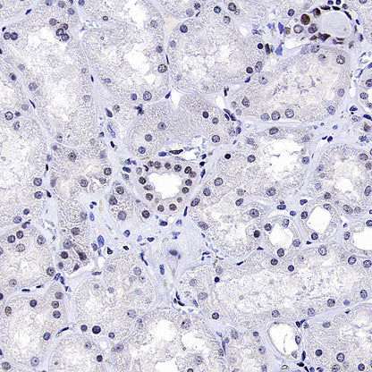 TOP2B Recombinant Rabbit mAb (S-4452-44)