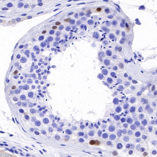 S-RMab®SALL4 Recombinant Rabbit mAb (SDT-R232)