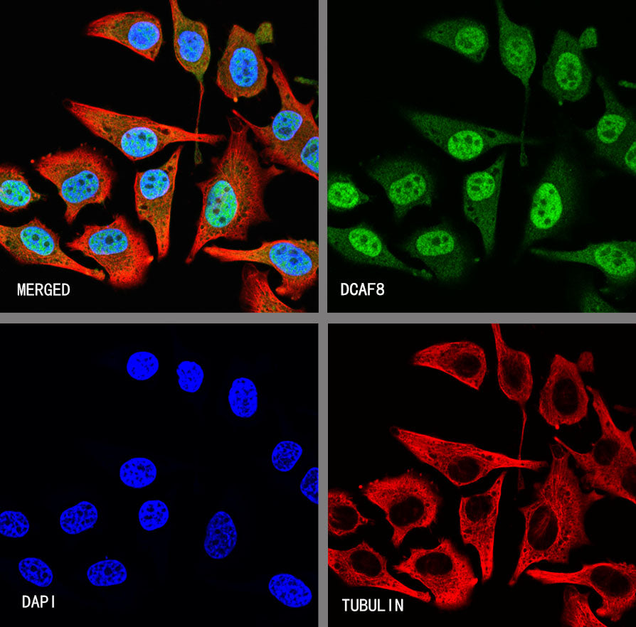 DCAF8 Recombinant Rabbit mAb (S-3483-11)