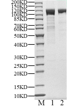 PRKD2 His&GST Tag Protein, Human