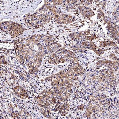 KL Recombinant Rabbit mAb (S-2245-169)