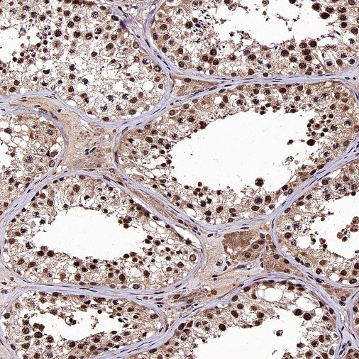 DNA Ligase IV/LIG4 Recombinant Rabbit mAb (S-2237-118)