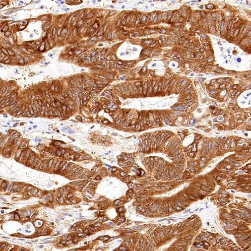 PABP Recombinant Rabbit mAb (S-1744-42)