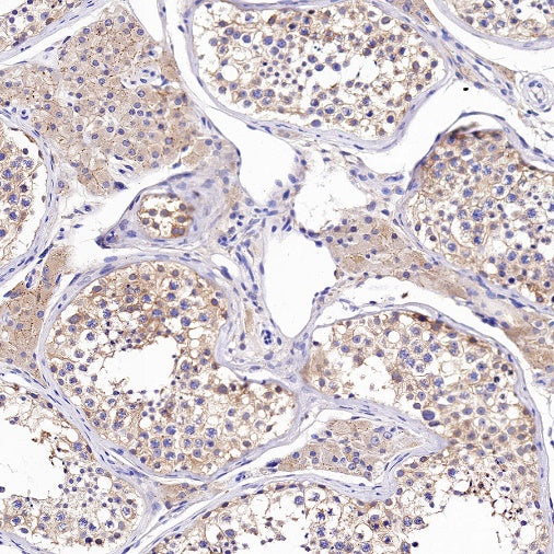 Tuberin/TSC2 Recombinant Rabbit mAb (S-1138-125)