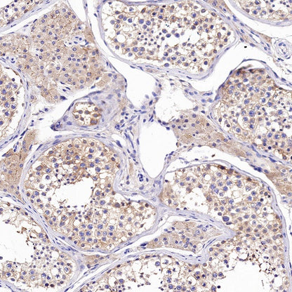 Tuberin/TSC2 Recombinant Rabbit mAb (S-1138-125)