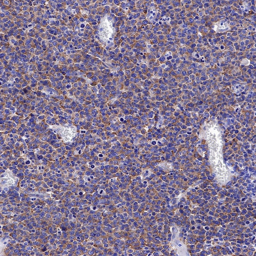 S6 Ribosomal Protein Recombinant Rabbit mAb (S-479-1)