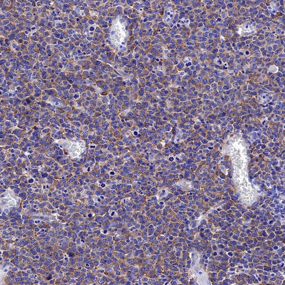 S6 Ribosomal Protein Recombinant Rabbit mAb (S-479-1)