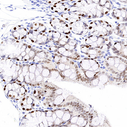 PAPSS1 Recombinant Rabbit mAb (S-3516-23)
