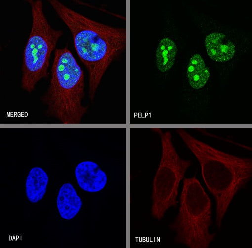 PELP1 Recombinant Rabbit mAb (S-756-22)