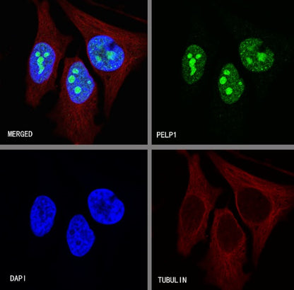 PELP1 Recombinant Rabbit mAb (S-756-22)