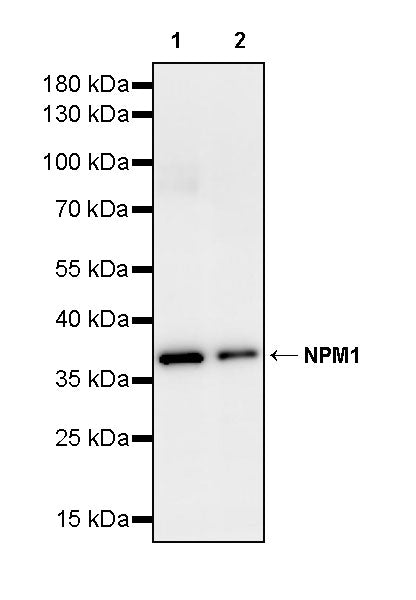 NPM1 Recombinant Rabbit mAb (S-4119-58)