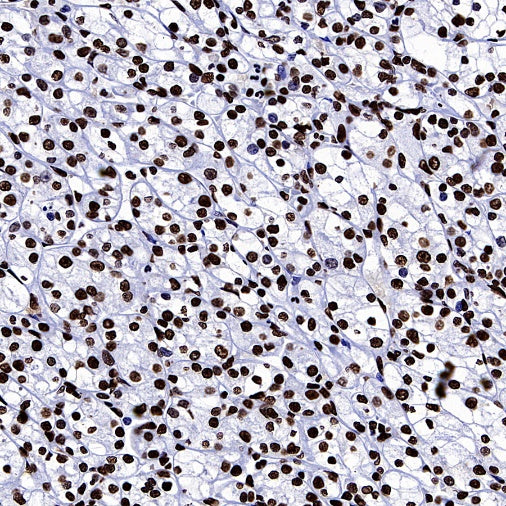 hnRNP U Recombinant Rabbit mAb (S-2375-23)