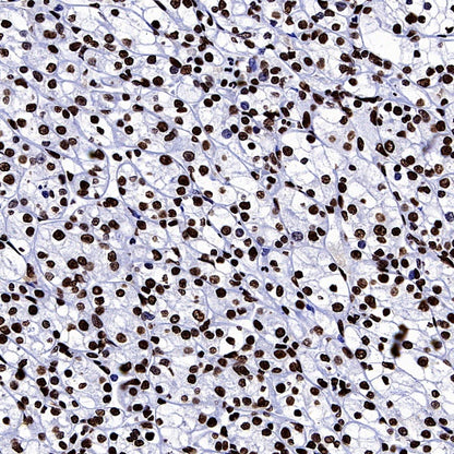 hnRNP U Recombinant Rabbit mAb (S-2375-23)