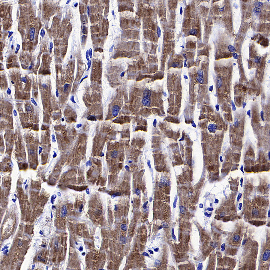 Monoamine Oxidase B/MAOB Recombinant Rabbit mAb (S-5317)