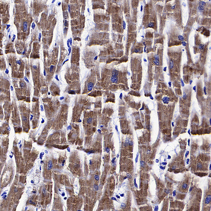 Monoamine Oxidase B/MAOB Recombinant Rabbit mAb (S-5317)