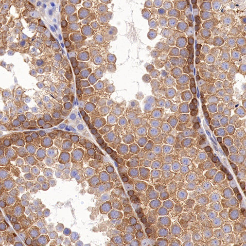 Beclin-1 Recombinant Rabbit mAb (S-761-15)