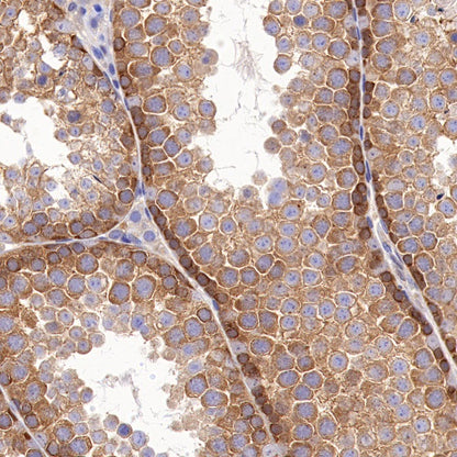 Beclin-1 Recombinant Rabbit mAb (S-761-15)