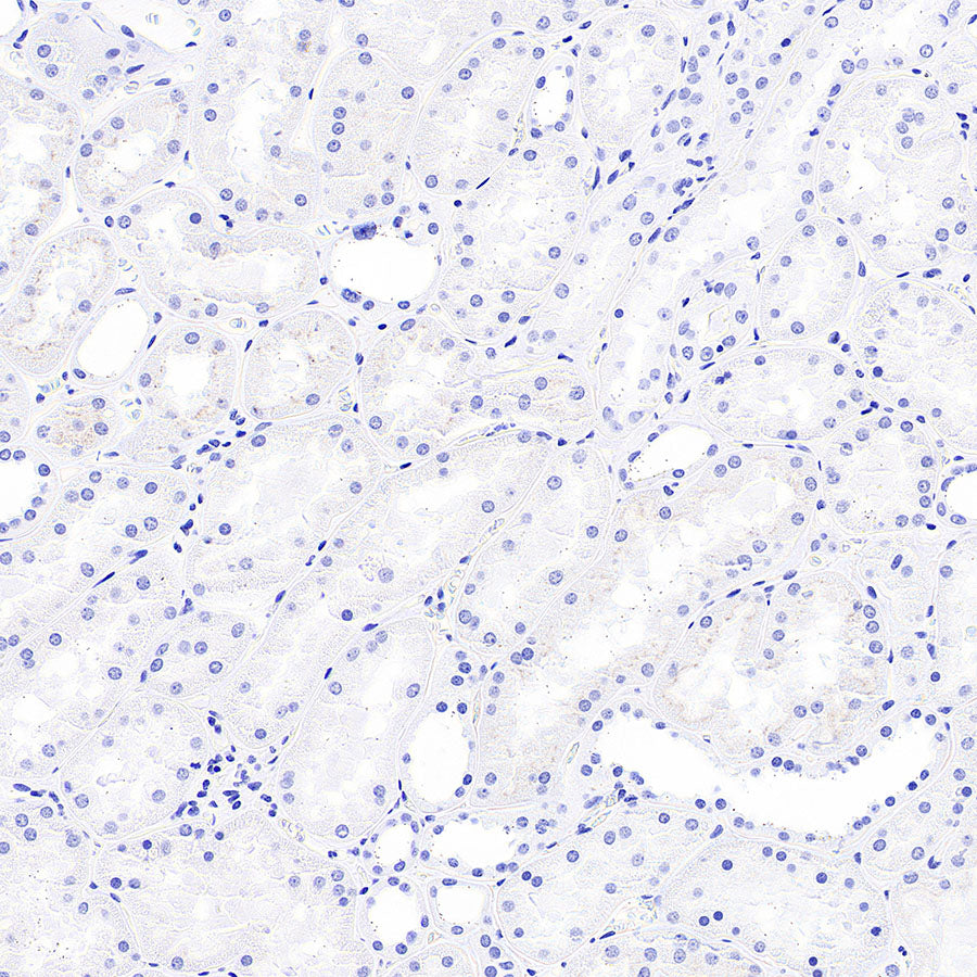 Myoglobin Recombinant Rabbit mAb (S-6197)