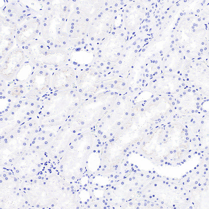 Myoglobin Recombinant Rabbit mAb (S-6197)