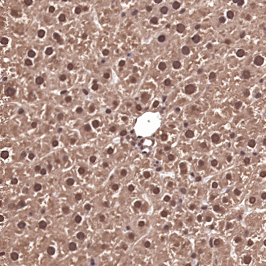 Ubiquitin Rabbit mAb (SDT-R095)