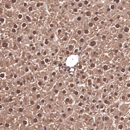 Ubiquitin Rabbit mAb (SDT-R095)