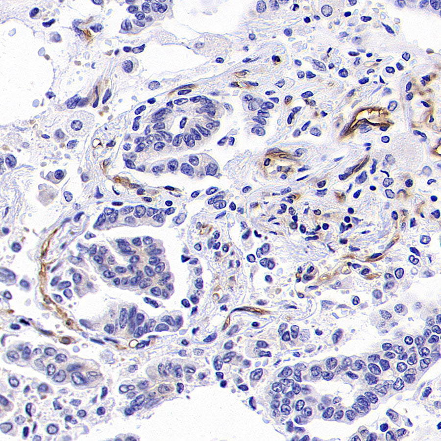 ICAM2/CD102 Rabbit Polyclonal Antibody