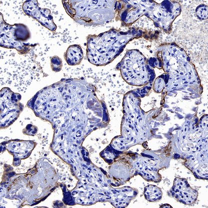 NOD2 Recombinant Rabbit mAb (SDT-3245-112)