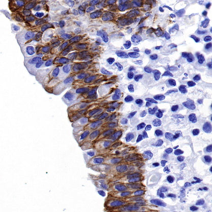 CK-13 Recombinant Rabbit mAb (SDT-641-41)