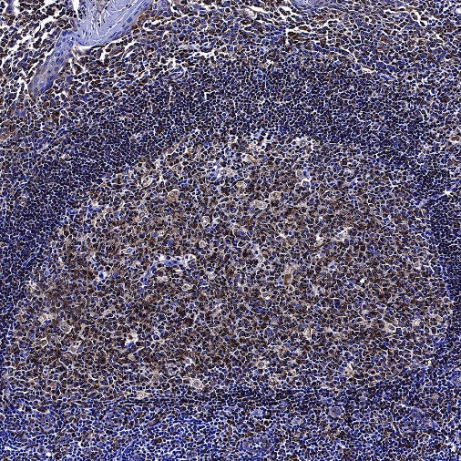 CD74 Recombinant Rabbit mAb (S-4524-58)