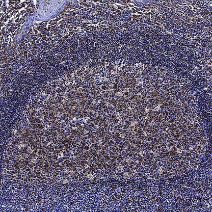 CD74 Recombinant Rabbit mAb (S-4524-58)