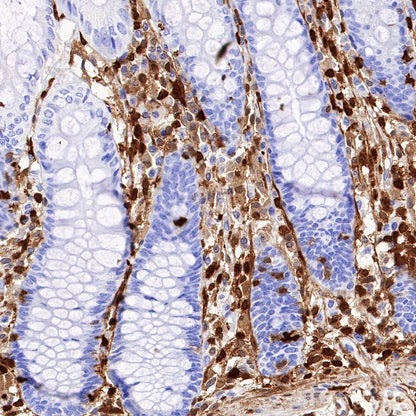 S100A4 Recombinant Rabbit mAb (S-1655-26)