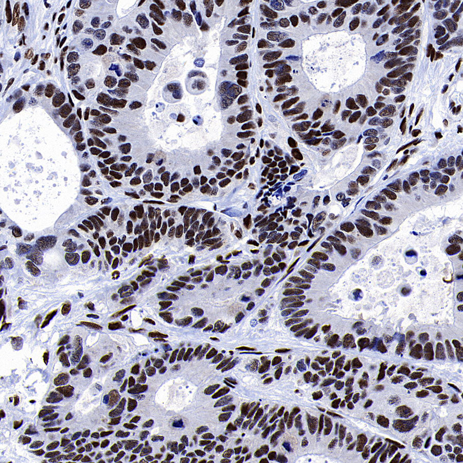53BP1 Recombinant Rabbit mAb (S-3170-149)