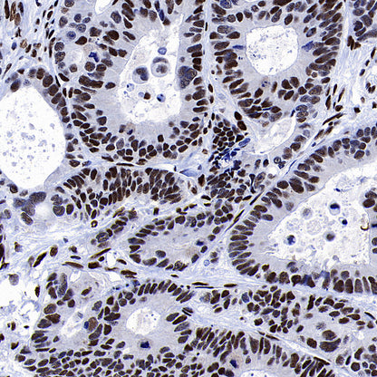 53BP1 Recombinant Rabbit mAb (S-3170-149)