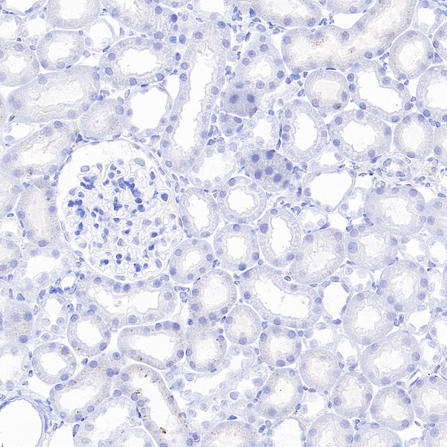 CaV2.3 (CACNA1E) Recombinant Rabbit mAb (S-3244-59)