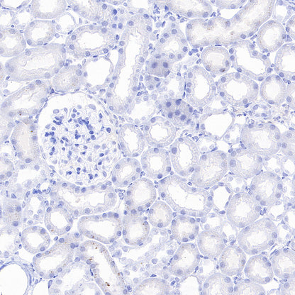 CaV2.3 (CACNA1E) Recombinant Rabbit mAb (S-3244-59)