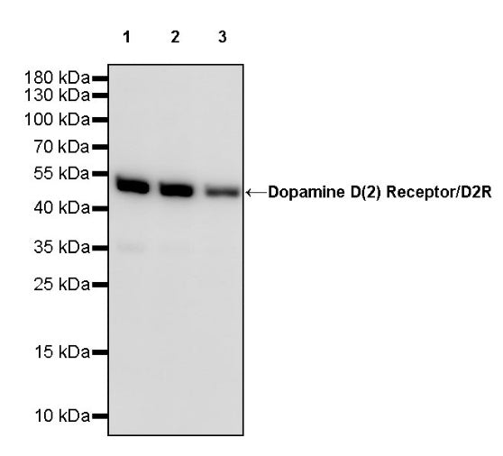 Dopamine D (2) Receptor/D2R Recombinant Rabbit mAb (S-2127-37)