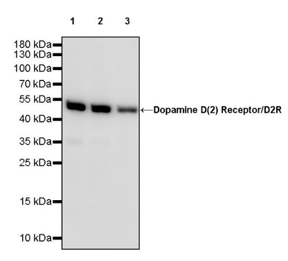 Dopamine D (2) Receptor/D2R Recombinant Rabbit mAb (S-2127-37)