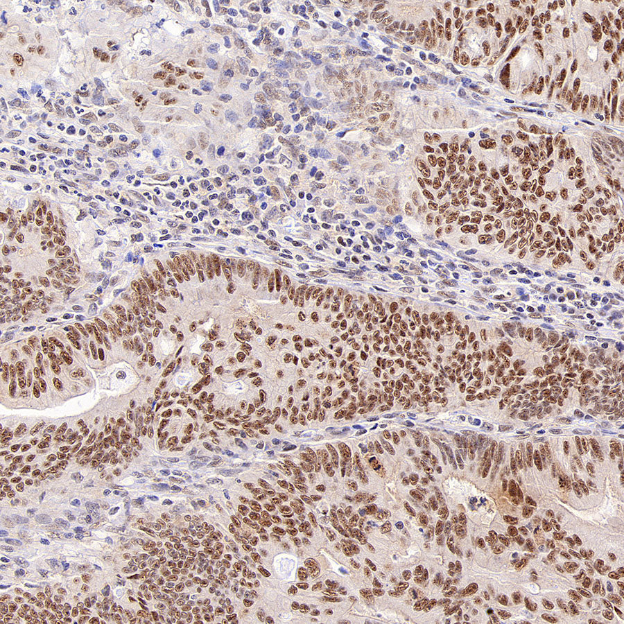 Phospho-Cdc25A (Ser124) Recombinant Rabbit mAb (S-5057-5)