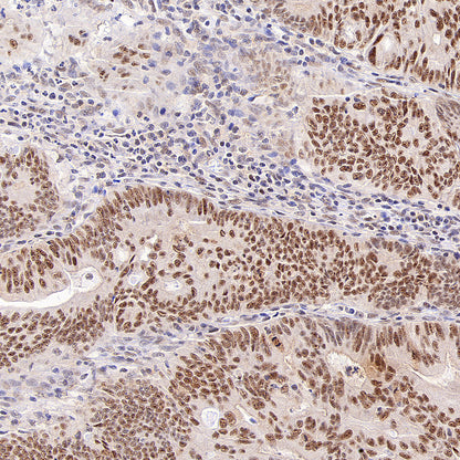 Phospho-Cdc25A (Ser124) Recombinant Rabbit mAb (S-5057-5)