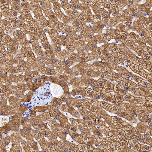 ALDH1L1 Recombinant Rabbit mAb (S-2885-49)