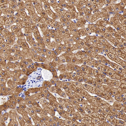 ALDH1L1 Recombinant Rabbit mAb (S-2885-49)