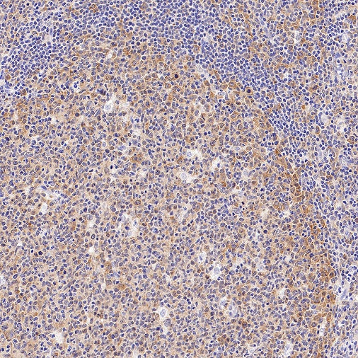 eIF5A Rabbit Polyclonal Antibody