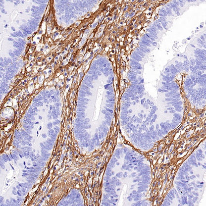 COL1A1 Recombinant Rabbit mAb (S-2975-9)