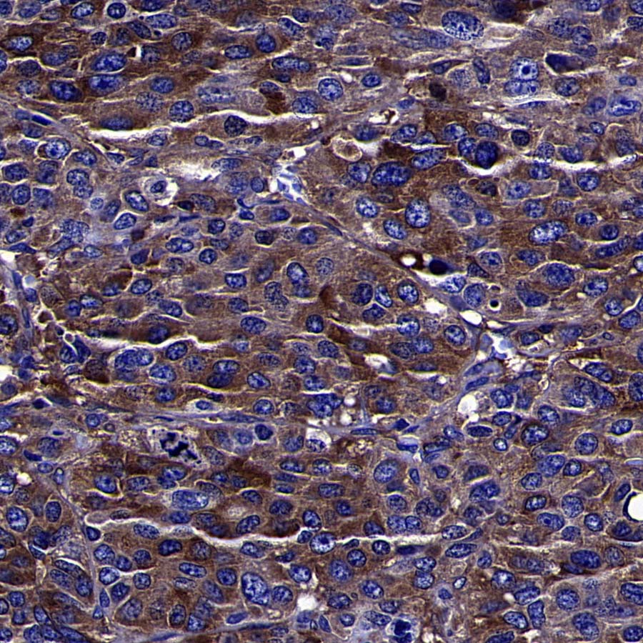 BIN1 Recombinant Rabbit mAb (S-4287-18)