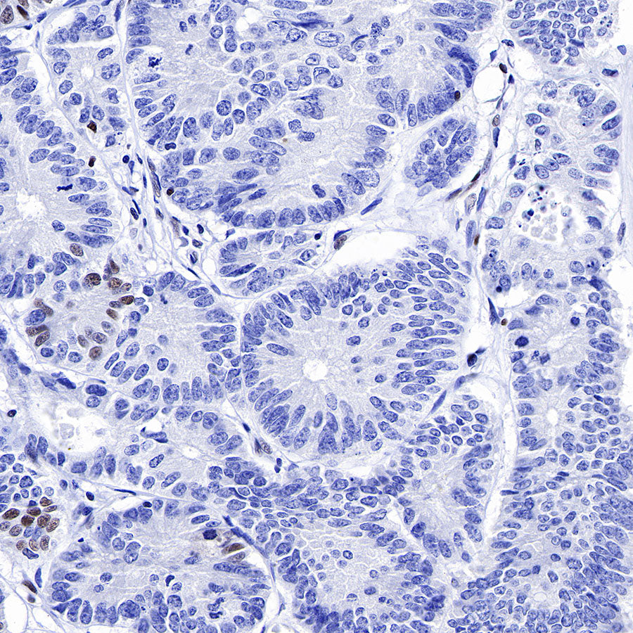 S-RMab® MSH6 Recombinant Rabbit mAb,PBS Only (SDT-R094)