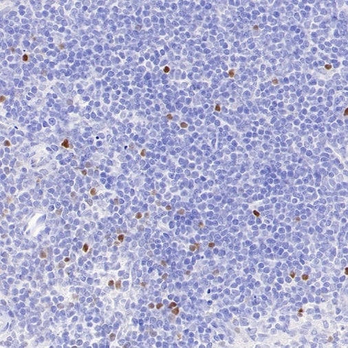 TBR2/Eomes Recombinant Rabbit mAb (SDT-1101-231)